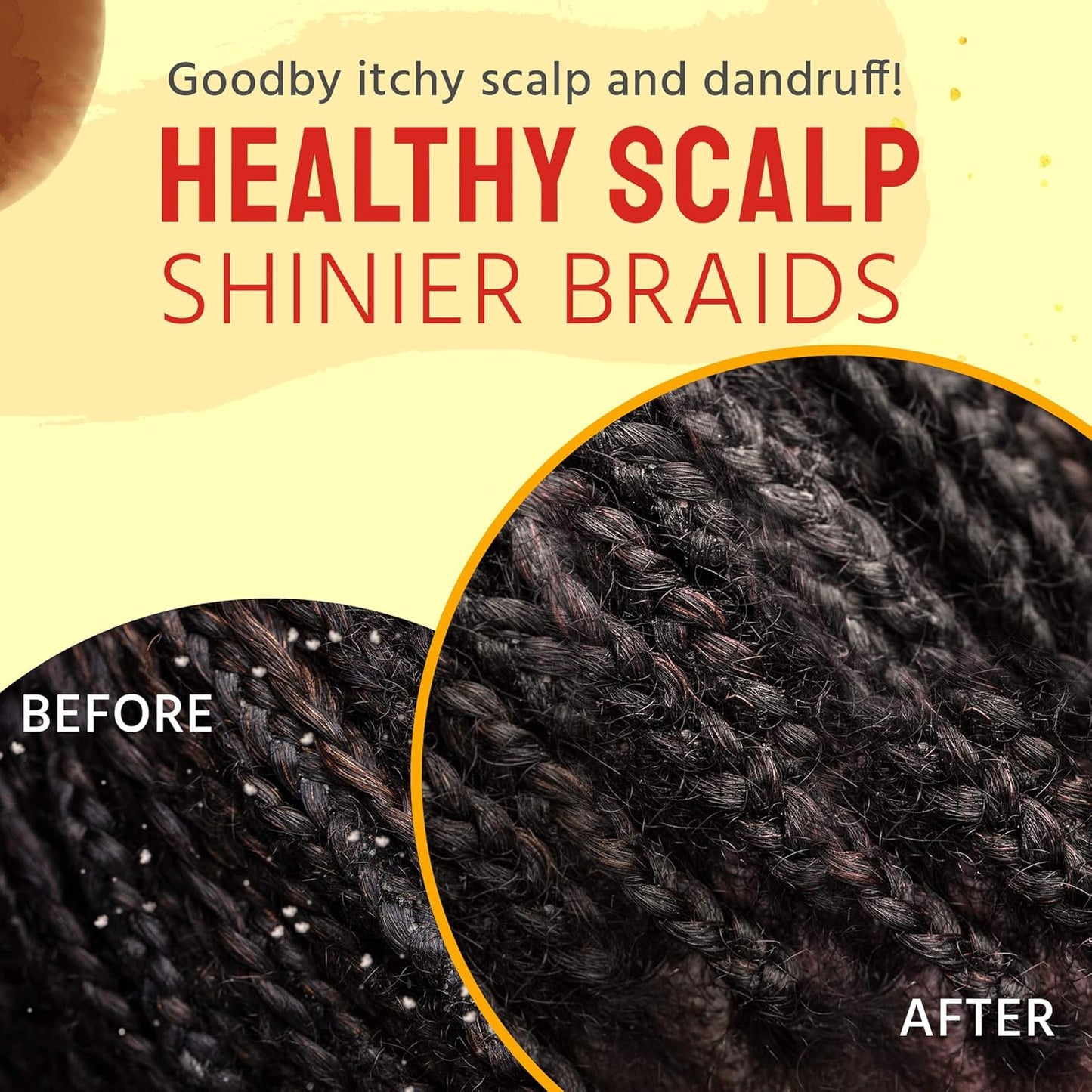 Glammed Naturally Dry Scalp Relief Oil (4 oz)