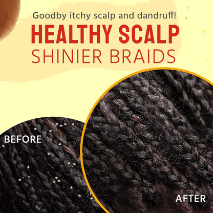 Glammed Naturally Dry Scalp Relief Oil (4 oz)